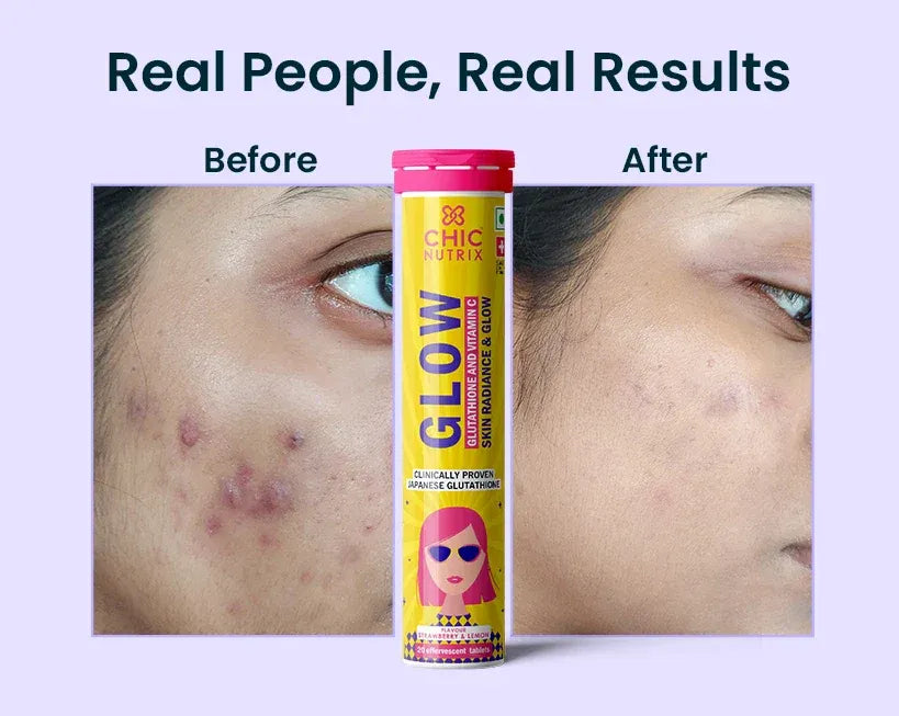 Chic Nutrix Glow | Éclat du Teint & Glutathion Japonais